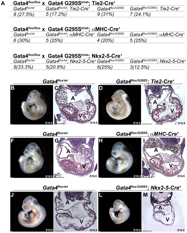 <i>Gata4 G295S</i> mutation has <i>in vivo</i> functional deficits in the early embryonic myocardium.