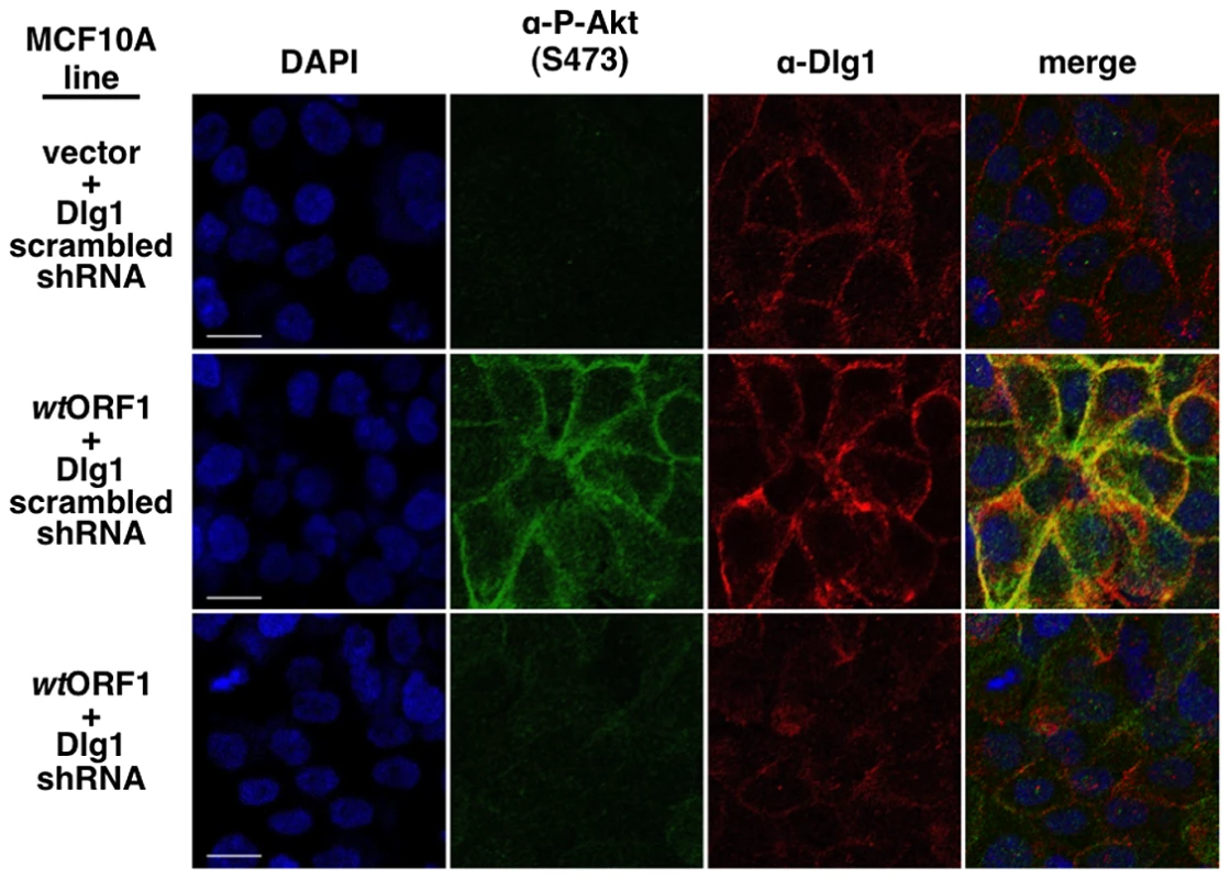 ShRNA-mediated Dlg1 depletion diminishes E4-ORF1-induced recruitment of P-Akt to the plasma membrane.