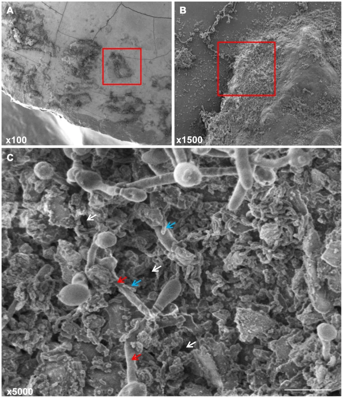 Scanning electron micrographs of mature mixed biofilms of <i>C. albicans</i> and <i>S. mutans</i> grown on extracted human teeth, demonstrating the tight coadherence between <i>C. albicans</i> hyphae (red arrows) and <i>S. mutans</i> cells (blue arrows).