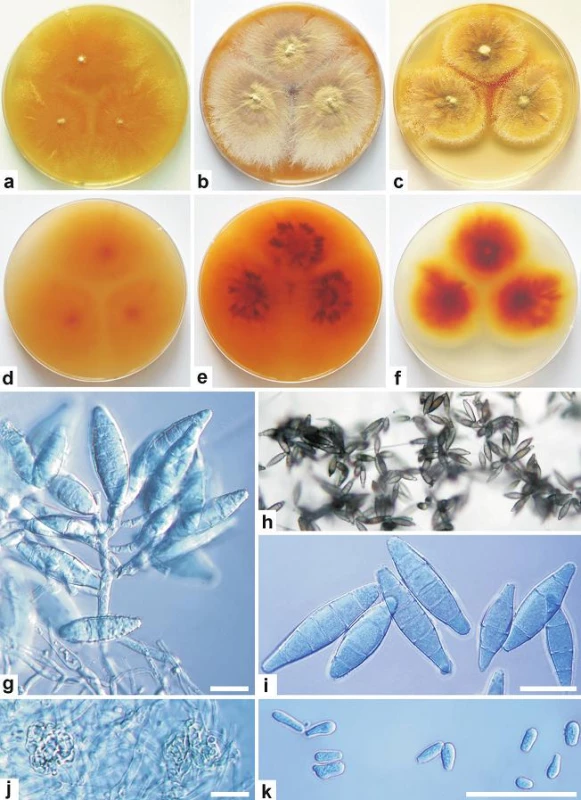 Morfologie Microsporum incurvatum CCF 4753