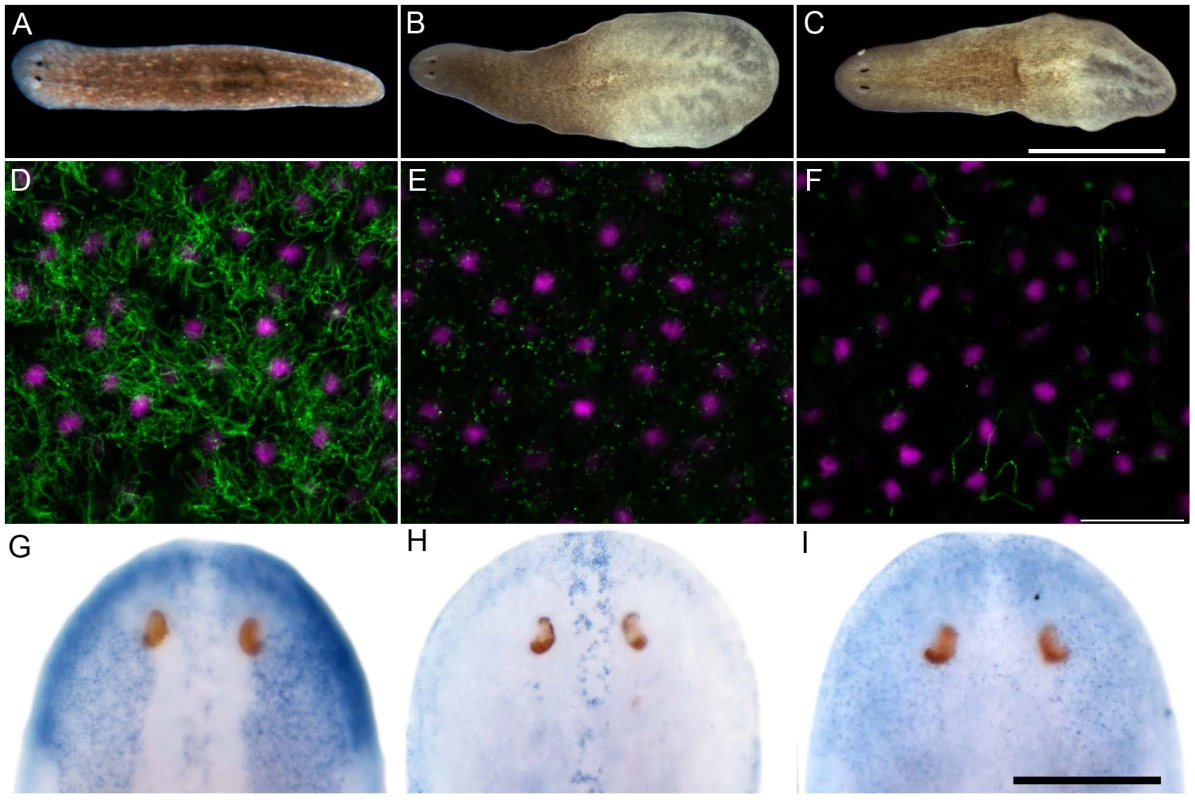 <i>S. mediterranea foxJ1-4</i> is required for the differentiation of motile cilia.