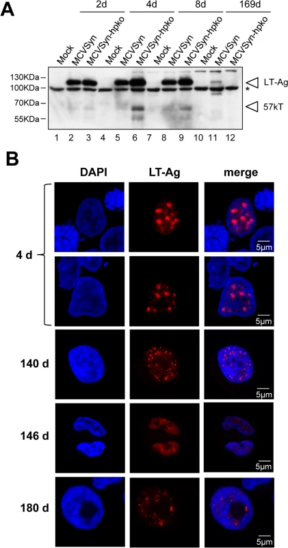 LT antigen expression in long term cultures of MCVSyn or MCVSyn-hpko transfected PFSK-1 cells.