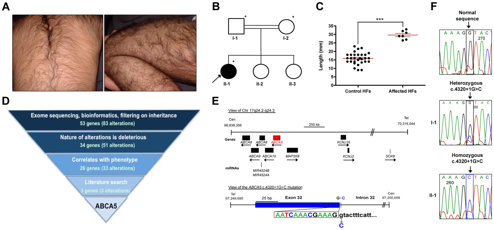 Whole-exome sequencing in a case of congenital generalized hypertrichosis terminalis (CGHT) revealed a splice site mutation in <i>ABCA5</i>.