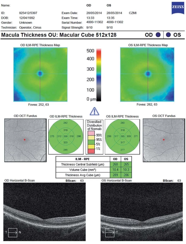 Vyšetření celkového makulárního objemu (Total Macular Volume; TMV) – fyziologický nález (Cirrus OCT HD).