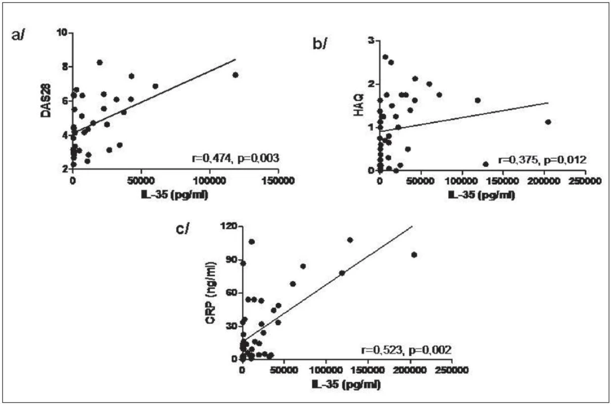Korelace hladin IL-35 v synoviální tekutině s DAS28 (a), HAQ (b) a CRP (c) u pacientů s RA.