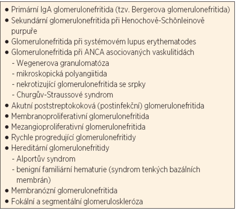 Glomerulonefritidy spojené s hematurií.