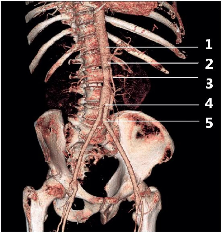 Anatomie průběhu břišní aorty