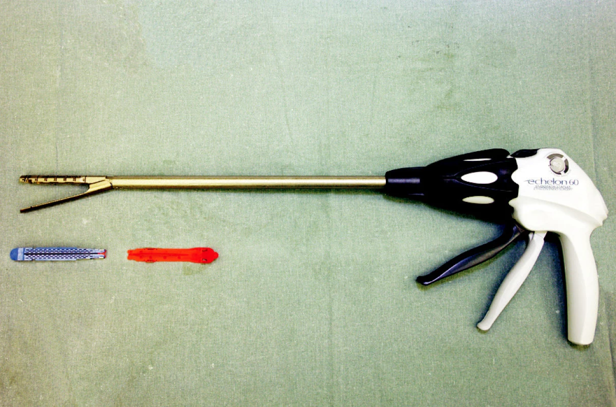 Resekční endostapler 60 mm
Fig. 3. Resection endostapler 60 mm