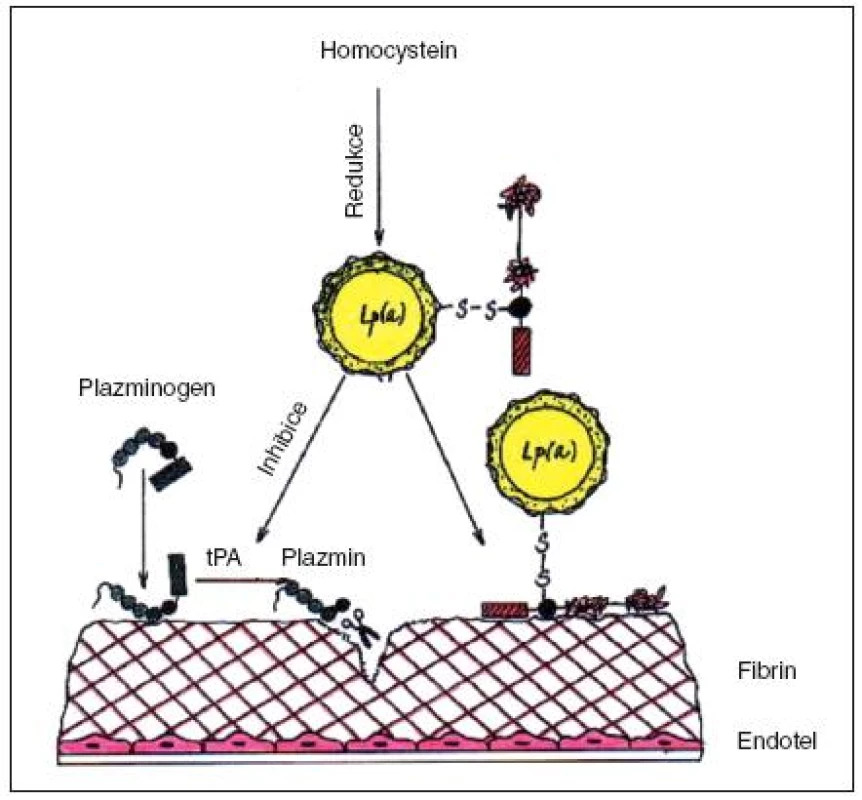 Interakce hyperhomocysteinemie a vysokého Lp(a), které působí inhibici trombolytického systému PAI-1 podle Chapmana (podrobnosti v textu) [33].