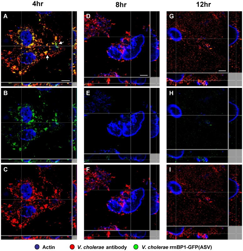 Single cell expression profiling and confocal microscopy of the growth-regulated <i>rrnBP1</i> promoter in ligated ileal loops.