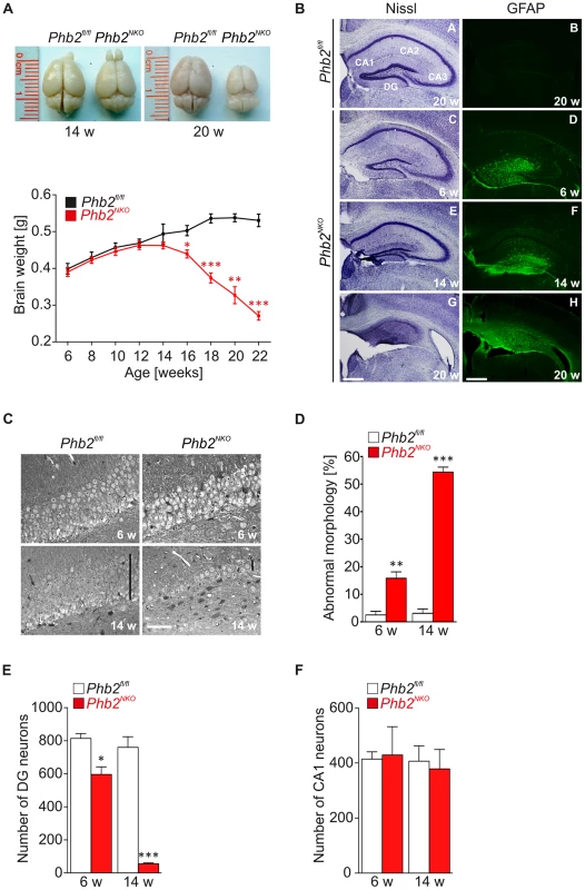 Progressive astrogliosis and loss of hippocampal neurons in <i>Phb2<sup>NKO</sup></i> mice.