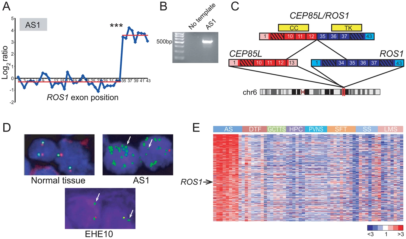 Discovery and characterization of <i>CEP85L/ROS1</i> in angiosarcoma.
