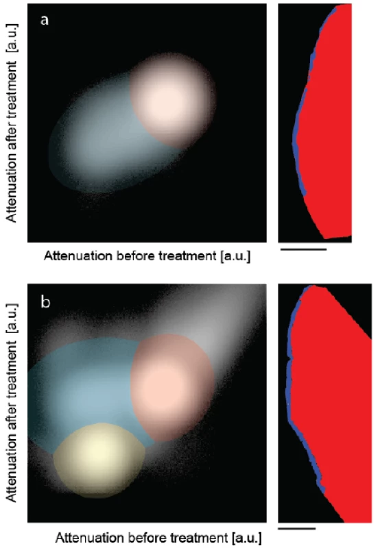 The joint histograms of the three-dimensional datasets allow segmenting the artificial lesions: (a) incubation of bare lesion and (b) incubation after peptide treatment. The selected virtual cuts through the sound enamel (red color) and the affected enamel (blue color) demonstrate the possibility of reliably segmenting the enamel lesion. The bar corresponds to the length of 500 μm.