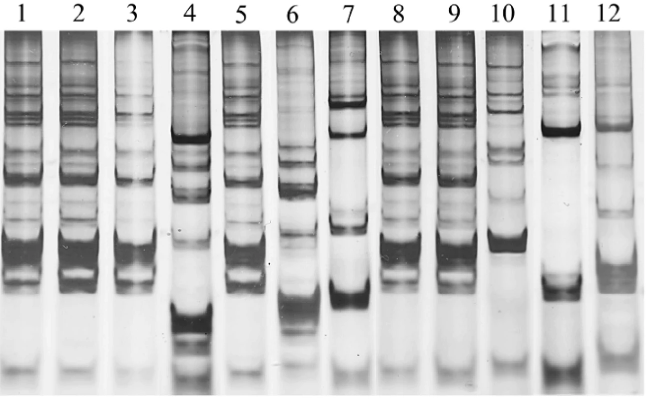 DNA fingerprint profiles of &lt;i&gt;L. paracasei&lt;/i&gt; SD1 contained in milk powder (lane 1) and 11 clinical lactobacilli strains (lanes 2–12) isolated from saliva of four individual children who received milk contained &lt;i&gt;L. paracasei&lt;/i&gt; SD1 at T9 of study: lanes 2–4, lanes 5–7, lanes 8–10, and lanes 11–12 isolates from child 1, 2, 3 and 4, respectively. The child 1, 2 and 3 had the isolates in lanes 2, 3, 5, 8 and 9, which showing the DNA fingerprint profiles similar to &lt;i&gt;L. paracasei&lt;/i&gt; SD1. &lt;i&gt;L. paracasei&lt;/i&gt; SD1 could not be detected in the child 4.