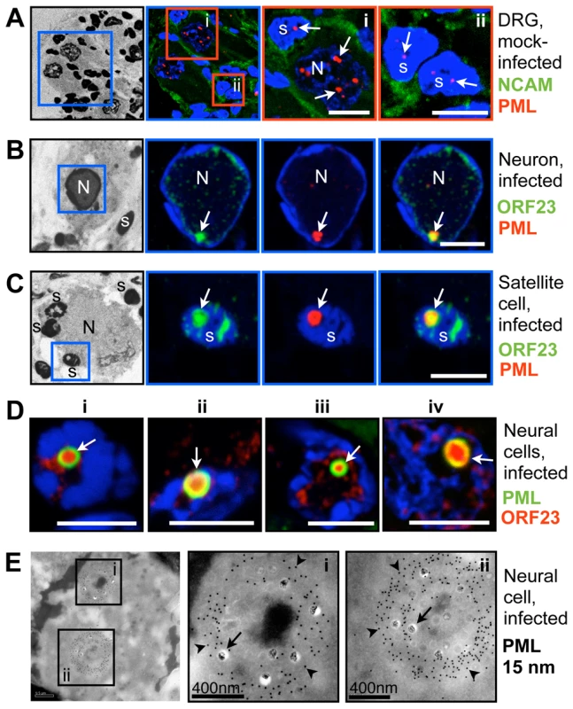 PML cages sequester VZV nucleocapsids during infection of human Dorsal Root Ganglia (DRG).