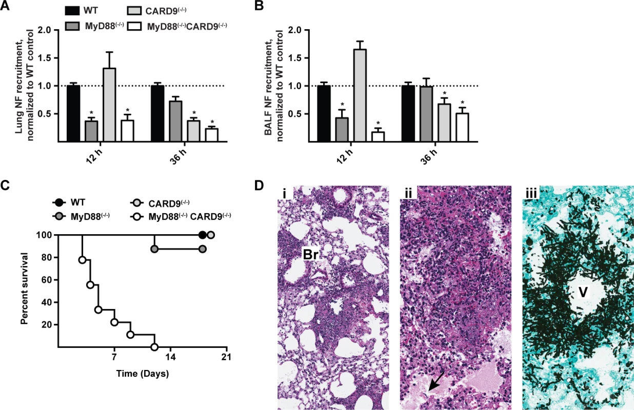 Effects of MyD88 and CARD9 are additive in murine defense against aspergillosis.