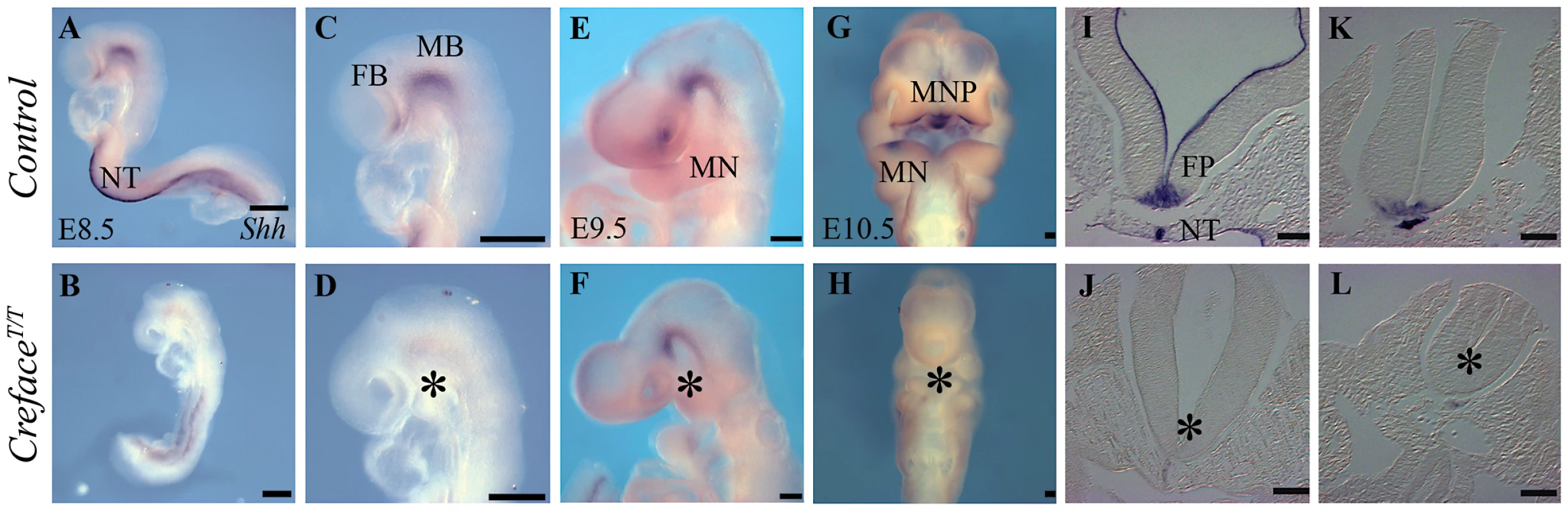 <i>Shh</i> expression is altered in <i>Hhat<sup>Creface/Creface</sup></i> embryos.