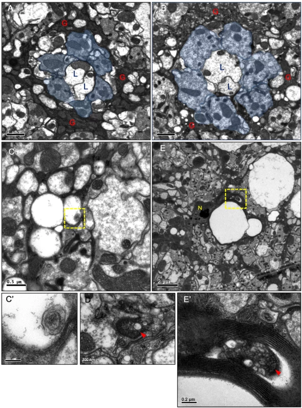 Vacuoles and autophagosome-like structures in the degenerating epithelial glia.