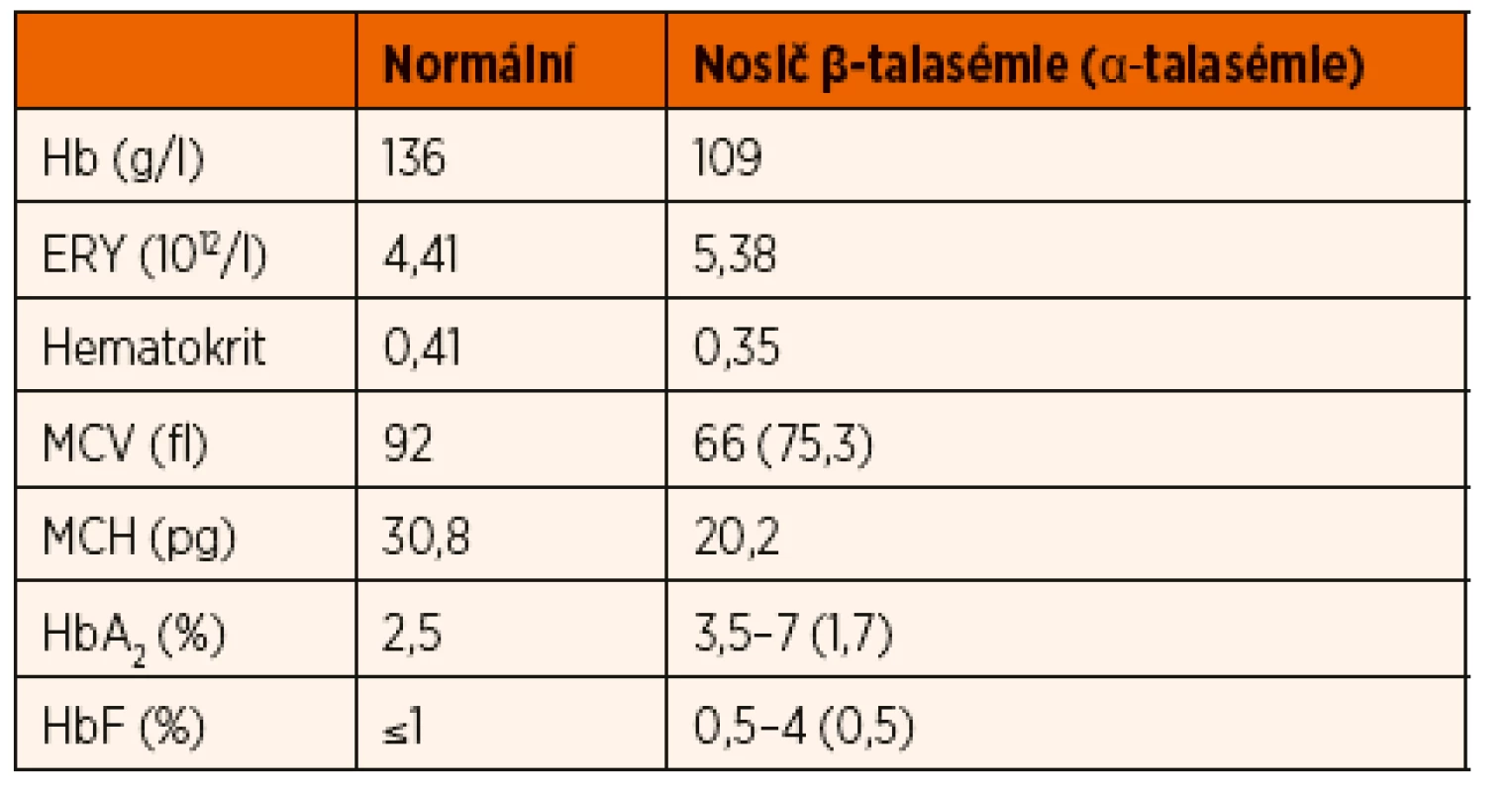 Typické hodnoty krevního obrazu u nosičů talasemické alely.