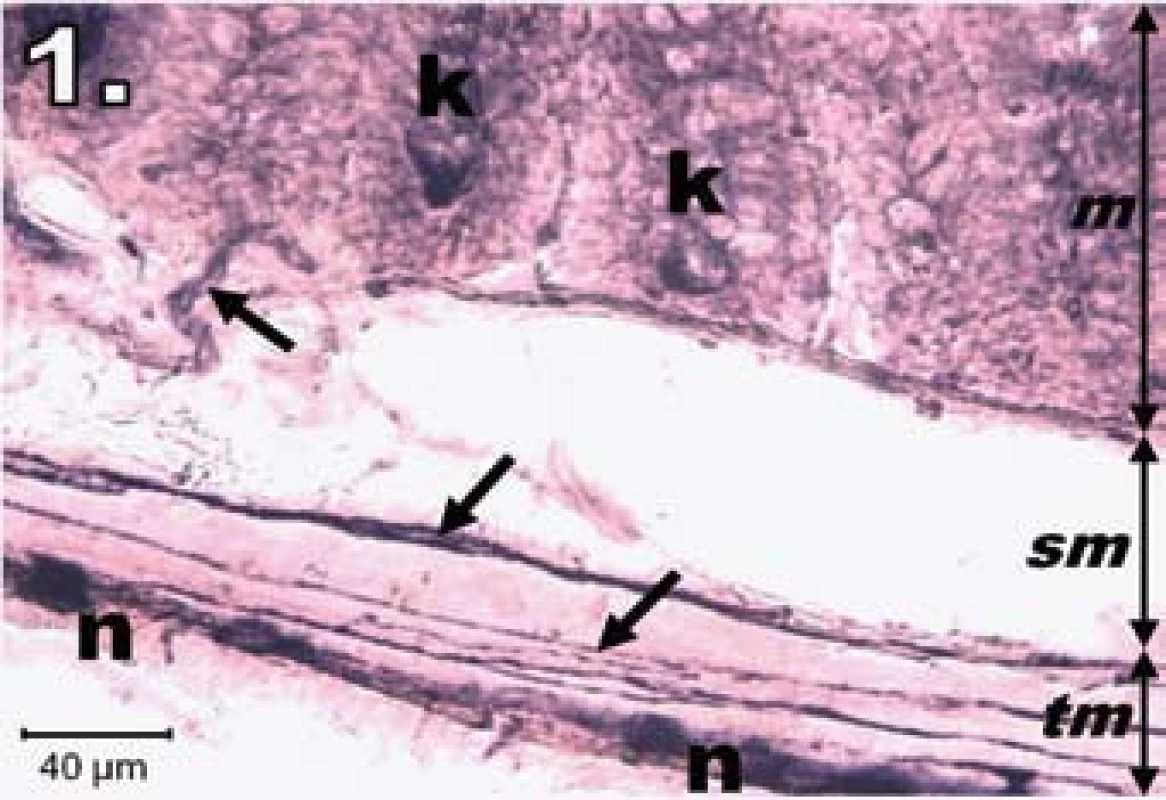 Histologický obraz jejuna v kontrolnej skupine. n – NADPH-d pozitívne neuróny silne pozitívne, šípky – nervové vlákna silne pozitívne, k – Lieberkühnove krypty s NADPH-d aktivitou na ich dne, m – mukóza, sm – submukóza, tm – tunica muscularis; scale bar = 40 μm
Fig. 1. Histological picture of jejunum in the control group. n – neurons fully NADPH-d positive, arrows – positive nerve fibres, k – positivity in Lieberkühn's crypts, m – mucosa, sm – submucosal layer, tm – tunica muscularis; scale bar = 40 μm