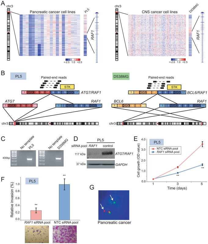 Identification and characterization of novel <i>RAF1</i> gene fusions in pancreatic cancer and anaplastic astrocytoma.