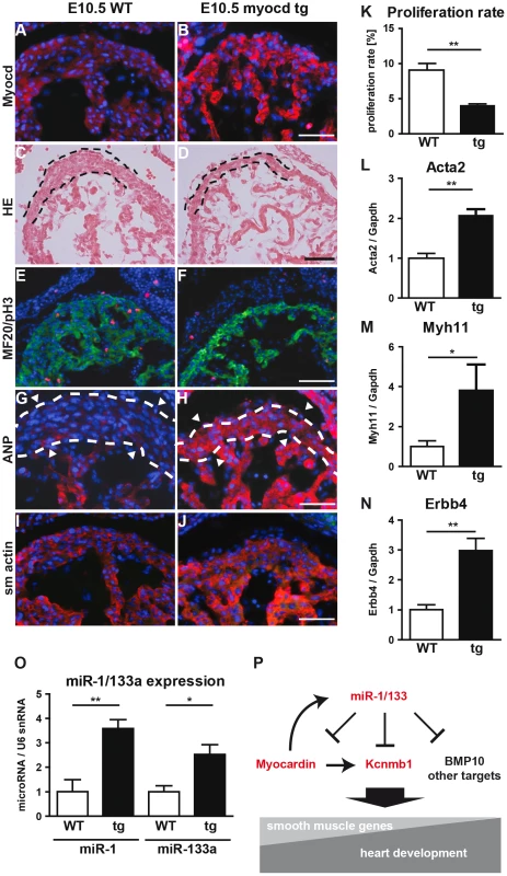 Transgenic overexpression of myocardin in the embryonic heart recapitulates the miR-1/133a phenotype.