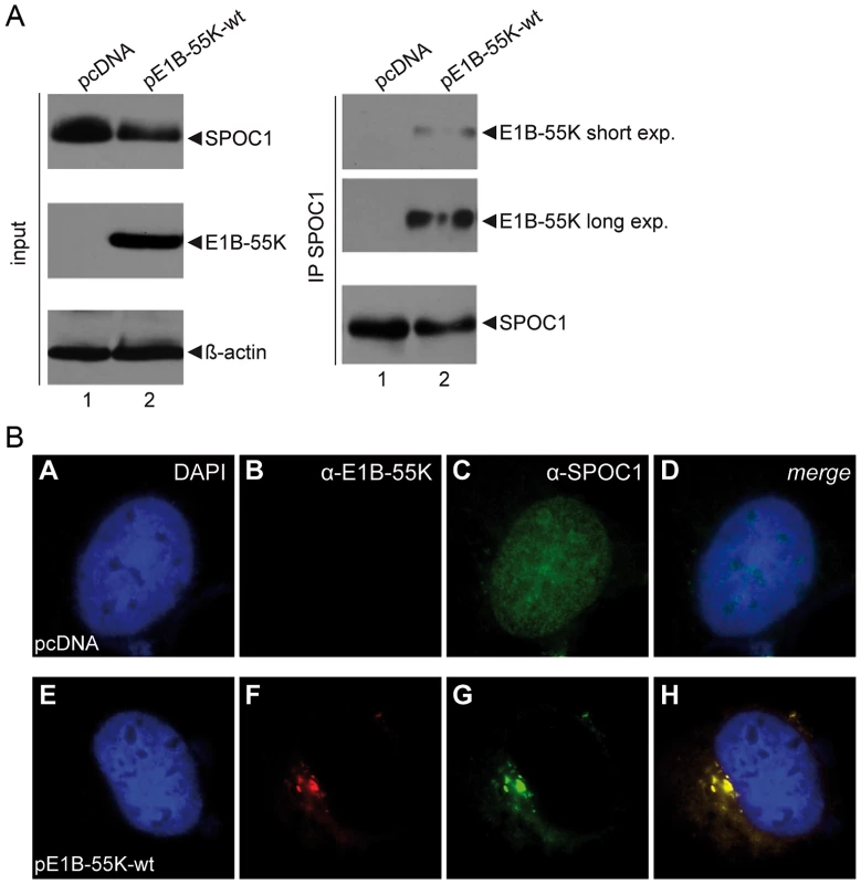SPOC1 is a novel interaction partner of viral E1B-55K protein.