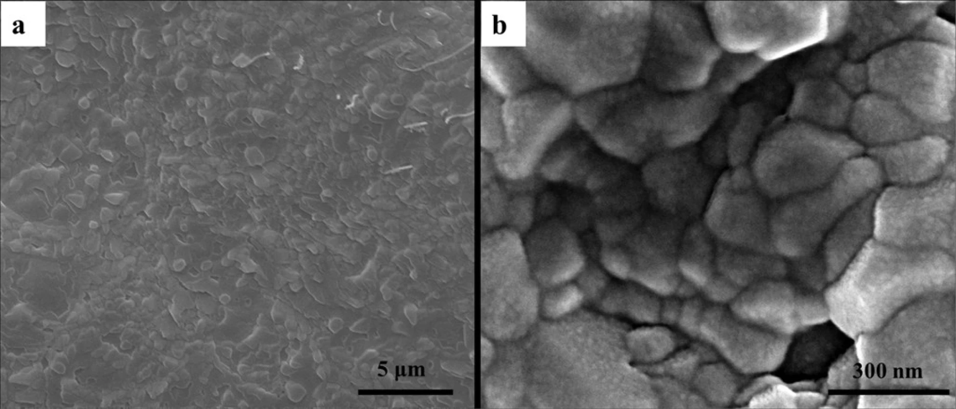 The surface morphology of scaffolds of CMC/ACP nanocomplexes characterized by SEM. (a), low magnification image showing irregular granuleson the sample surface; (b), high magnification image showing aggregation of nanoparticles on the granules.