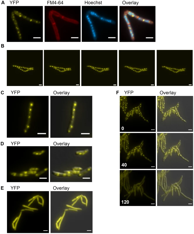 DnaK has growth phase dependent patterns of subcellular localization.