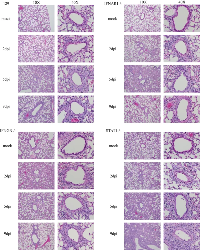 Histopathology of rMA15 virus infected mouse strains.