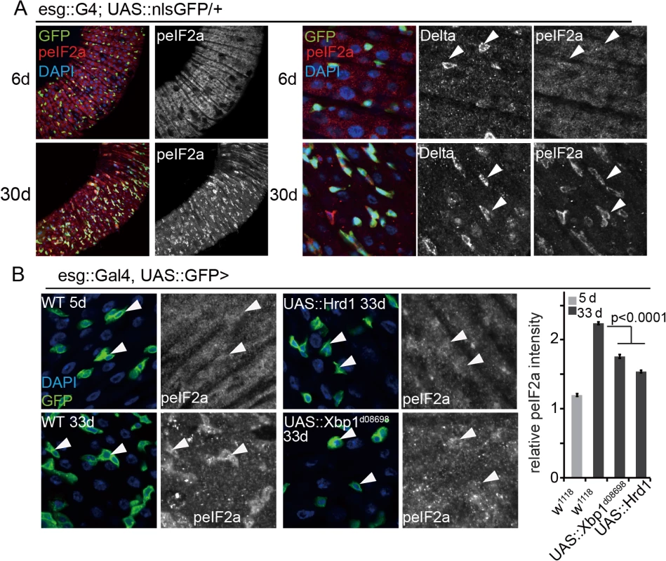 Limiting PERK activity in ISCs promotes intestinal homeostasis.