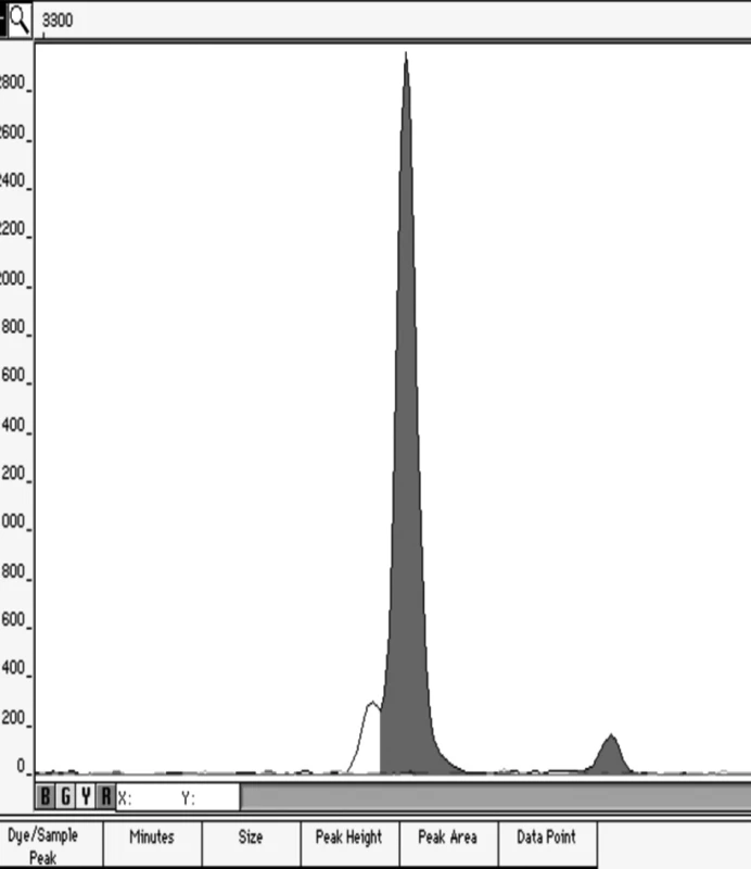 Elektroforetogram artificiální genotypické směsi v poměru 1:49
Ukázka elektroforetogramu genotypů XX/XY v poměru 49/1.