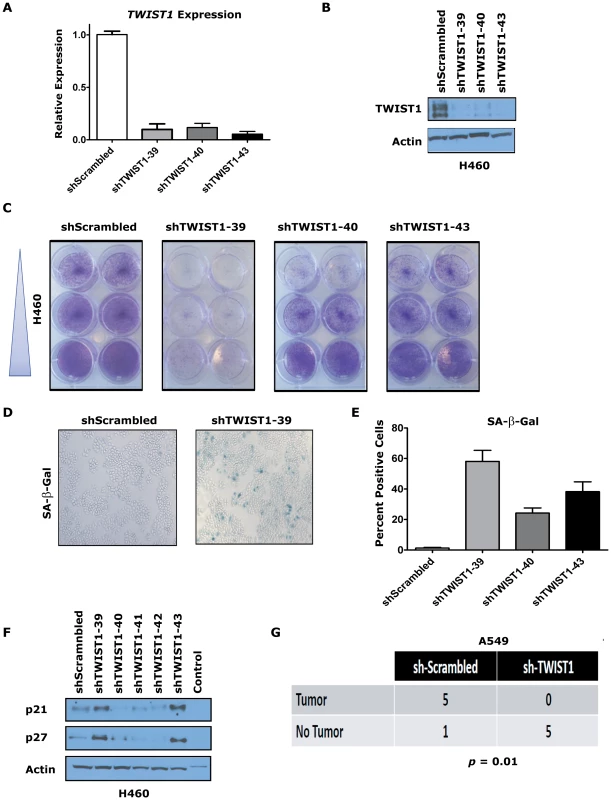 <i>TWIST1</i> knockdown activates senescence in human non-small cell lung cancer cells.
