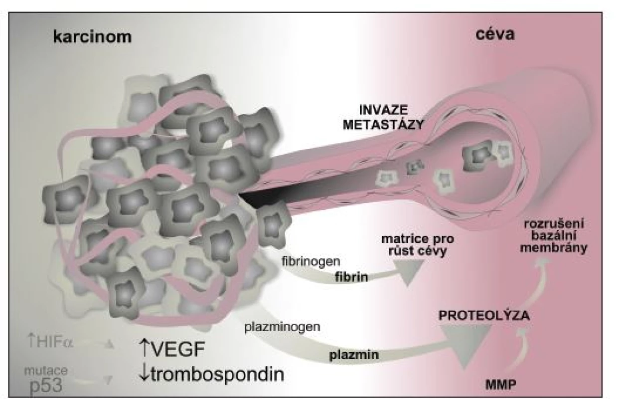 Vlivem proteolytických enzymů produkovaných nádorovými buňkami, vlivem kolagenázy IV. typu, aktivátoru plazminogenu a stromelyzinu produkovaných epiteliemi a stromálními buňkami dochází k rozrušení bazální membrány, což usnadňuje migraci endotelií i migraci nádorových buněk a jejich metastazování.