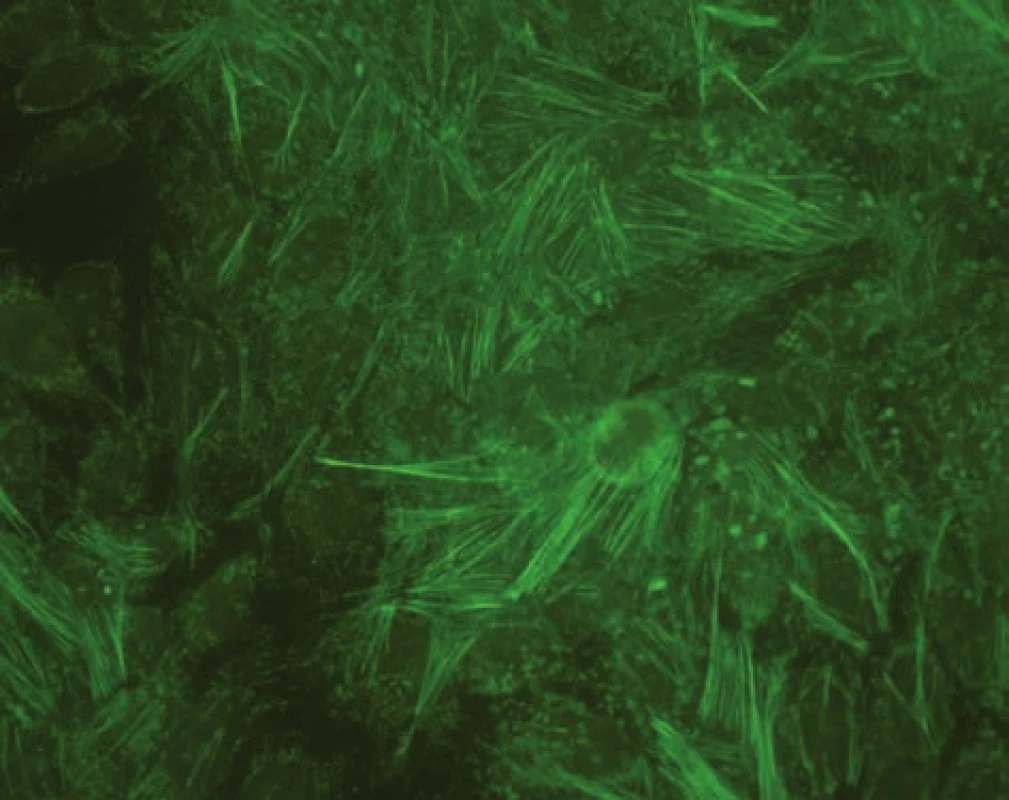 Imunofluorescenční obraz protilátek proti aktinu (substrát – buněčná linie Hep-2).
Fig. 2. Immunofluorescent image of anti-actin antibodies (substrate – Hep-2 cell line).