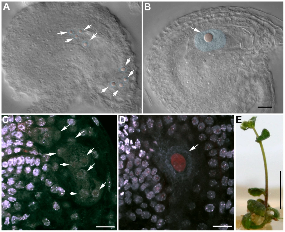 OSD1 and UVI4 are synthetically essential for female gametogenesis and somatic growth.