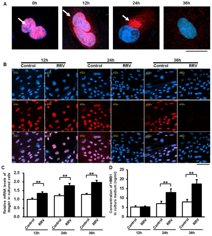Synthesis and release of HMGB1 induced by RRV infection on cultured cholangiocytes.