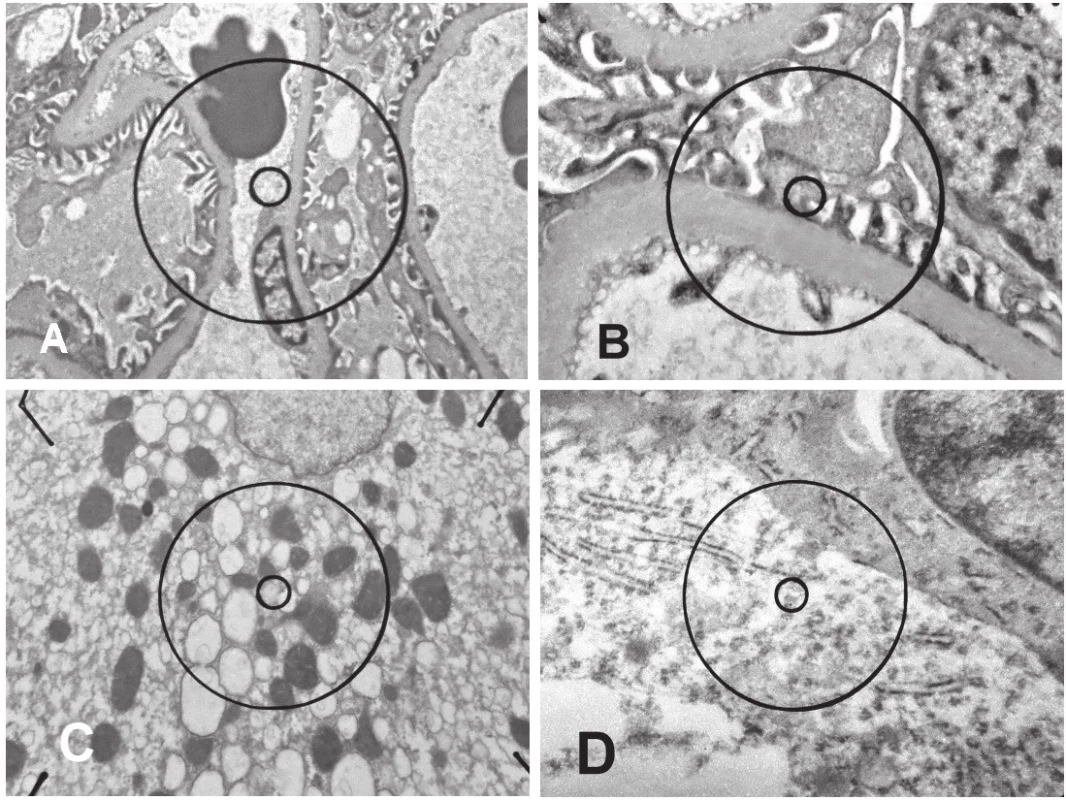Elektronogramy renálních glomerulů &lt;b&gt;(A, B)&lt;/b&gt; a hepatocytu &lt;b&gt;(C)&lt;/b&gt; po kontrastování ultratenkých řezů manganistanem draselným a octanem olova. Neuron s denzním oligodendrogliovým satelitem &lt;b&gt;(D)&lt;/b&gt; po kontrastování taninem a octanem olova.
