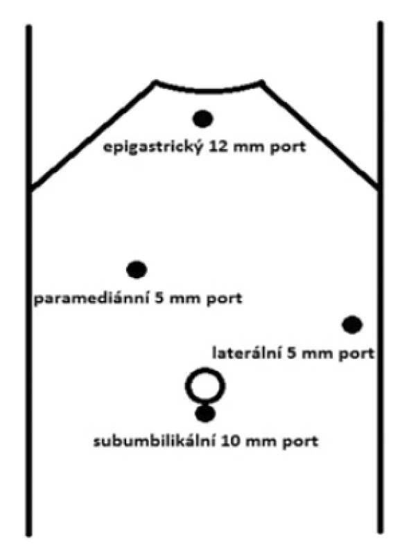 Rozložení portů<br>
Fig. 1: Port positions