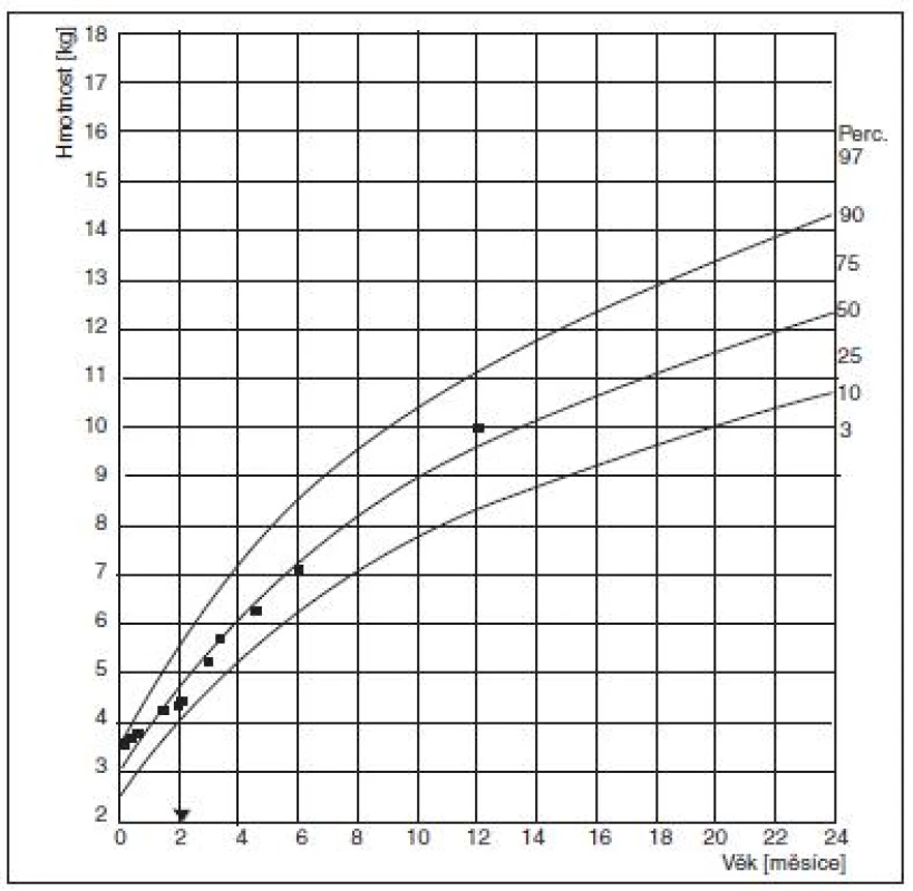 Růstový graf, hmotnost v průběhu 1. roku života. Je patrné snížení váhových přírůstků ve 2. měsíci života, rovněž patrný příznivý efekt operace, která je znázorněna šipkou na ose x. (Vytvořeno s použitím citace 19)
Fig. 1. Growth curve, body mass in the course of the 1st year of life. The decreasing weight increments in the 2nd month of life are apparent as well as a favorable effect of the operation, which is depicted by arrow on the X axis. (Created according to reference 19.)