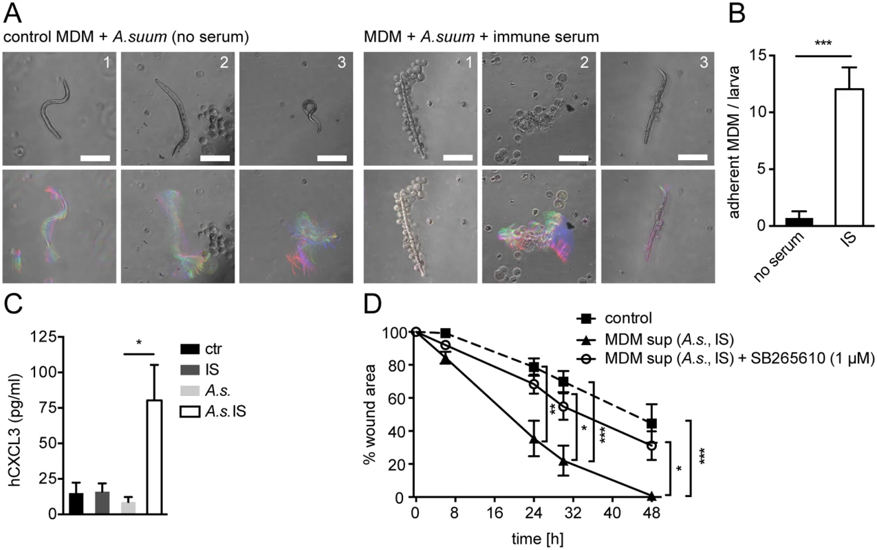 Conditioned media from <i>A</i>. <i>suum</i>-immune serum-activated MΦ promote in vitro scratch wound closure by human MF in a CXCR2 dependent fashion.