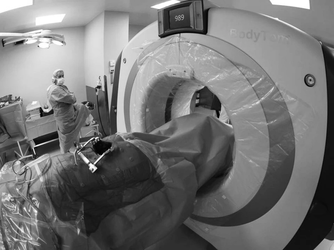 CT skener těsně před sejmutím intraoperačního obrazu
Fig. 1: The movable CT scanner just before taking the intraoperative scans