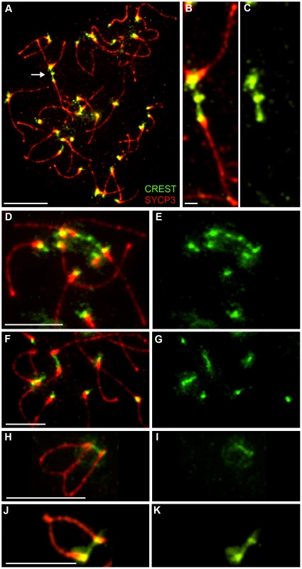 Identification of post-synapsis inter-centromeric CREST-staining bridges.