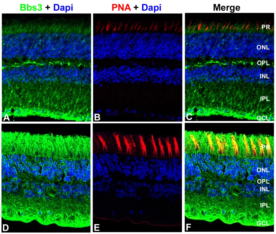 Localization of BBS3 in human and wild-type mouse retinas.