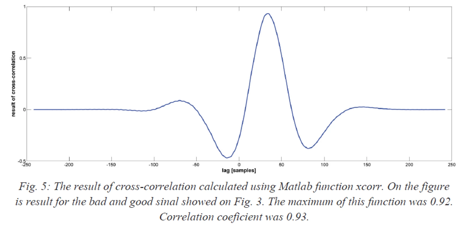 The result of cross-correlation calculated using Matlab function xcorr. On the figure is result for the bad and good sinal showed on Fig. 3. The maximum of this function was 0.92. Correlation coeficient was 0.93.