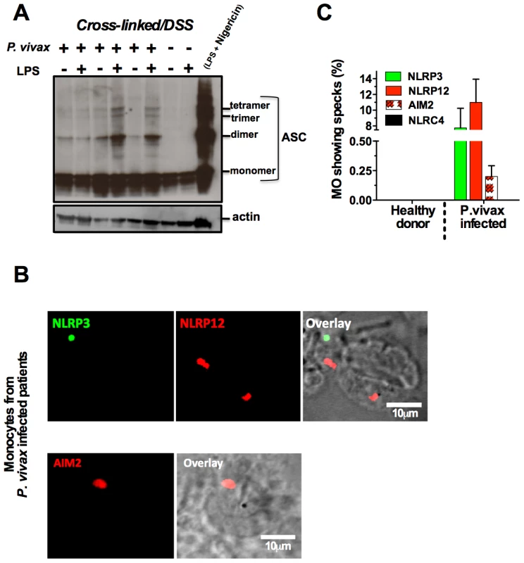 NLRP3/NLRP12 containing inflammasomes and caspase-1 activation in PBMCs from <i>P. vivax</i> malaria patients.