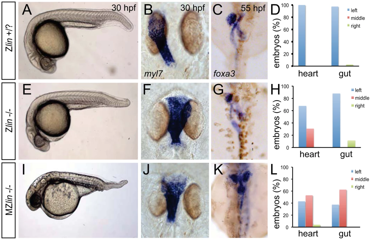Dorsoventral and laterality defects in zygotic and maternal zygotic <i>lin</i> mutant embryos.