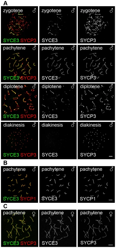 SYCE3 selectively localizes to the synapsed areas of homologous chromosomes.