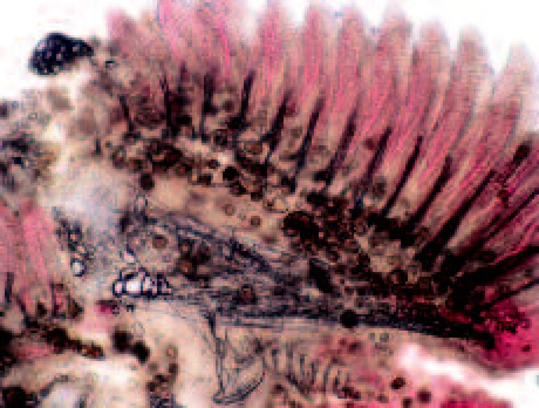 Četné granulomy v žábrech čichavce perleťového (Trichogaster leeri), nativní preparát, zvětšeno 20x (foto L. Novotný).