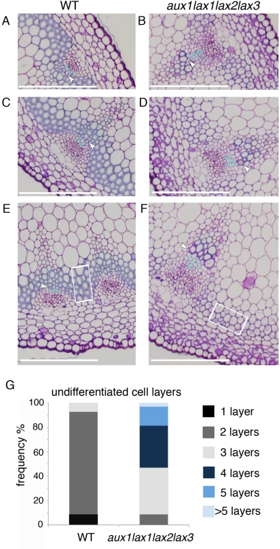 Influx carrier mutants show impaired xylem differentiation in Arabidopsis shoot stem.